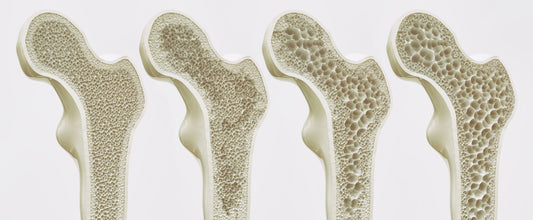 Difference in bone density - how it looks like.